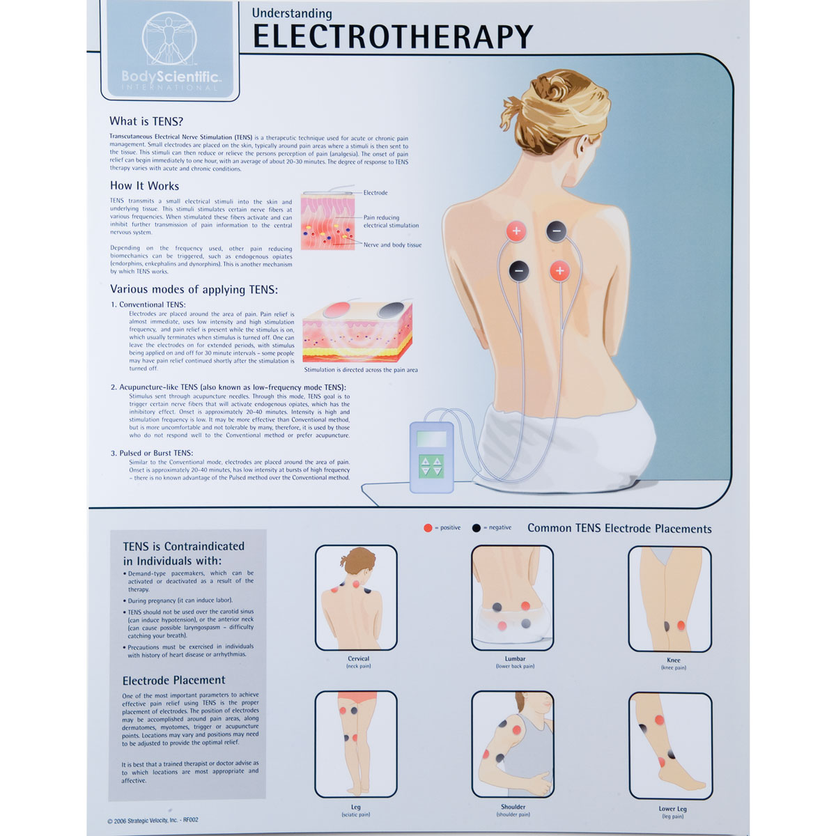 W59506 01 1200 1200 Electrotherapy Chart Laminated